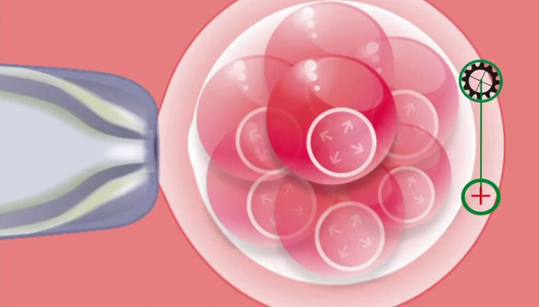 Laser Assisted Hatching Procedure In Noida Fertility Clinic In Noida