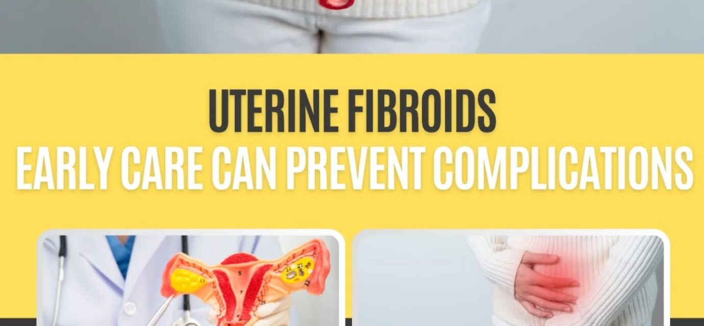 Uterine fibroids Uterine fibroids Support by Dr Rakhi