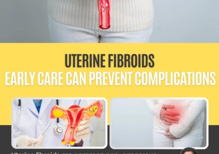 Uterine fibroids Support by Dr Rakhi