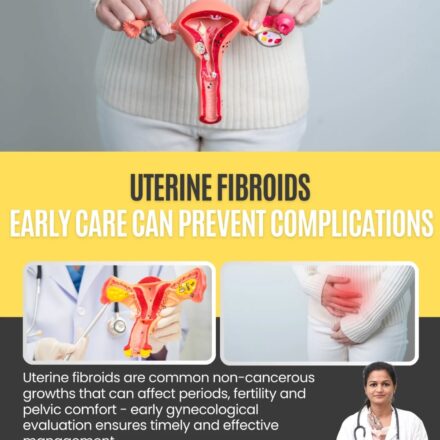 Uterine fibroids Support by Dr Rakhi