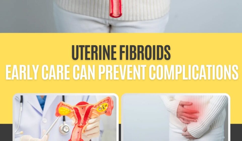 Uterine fibroids Support by Dr Rakhi