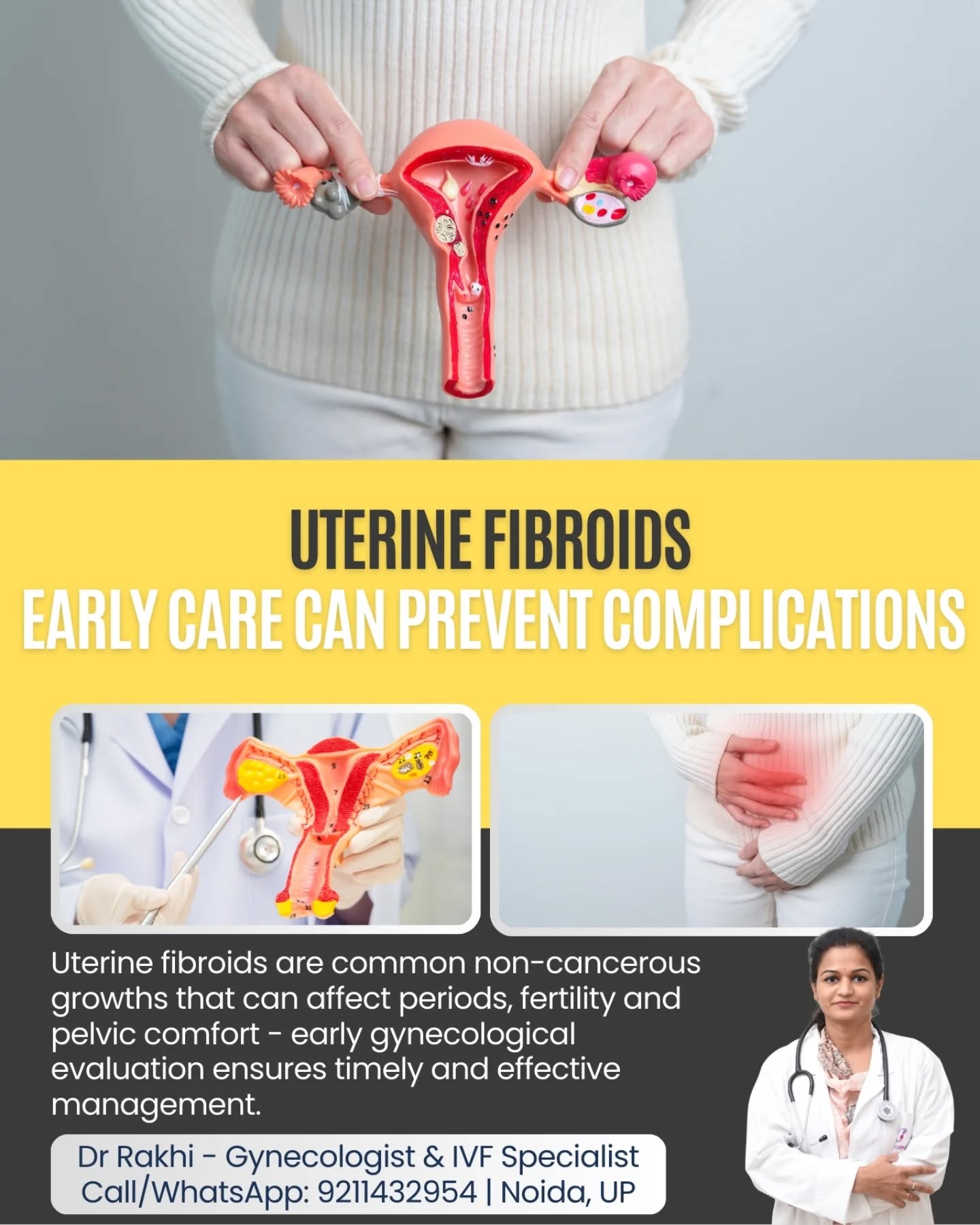 Uterine fibroids